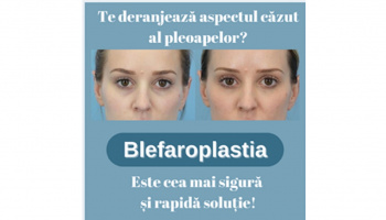 Operația de blefaroplastie superioară